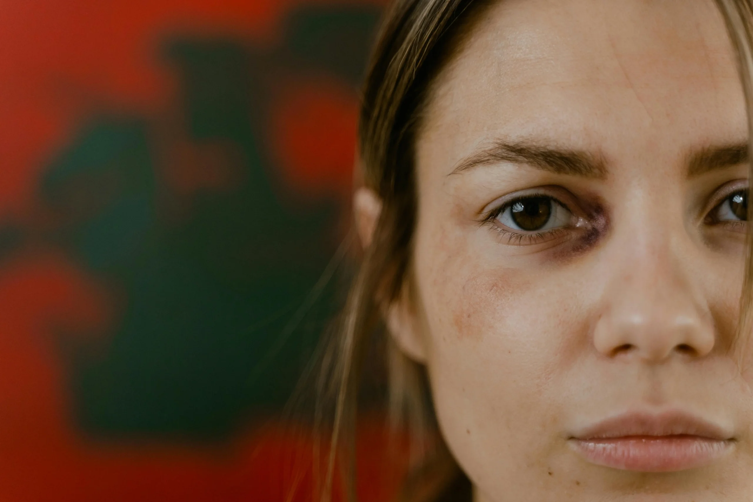 Physical-Impact-of-Emotional-Abuse-in-Relationships